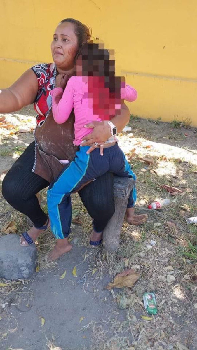 ultimahsv's tweet photo. #Nacionales | En San Pedro Masahuat, una niña sufrió graves heridas tras ser atacada por un perro de raza pitbull, que fue descuidado por sus dueños, mientras la niña repartía tortillas junto a su madre. https://t.co/bo002eniCx