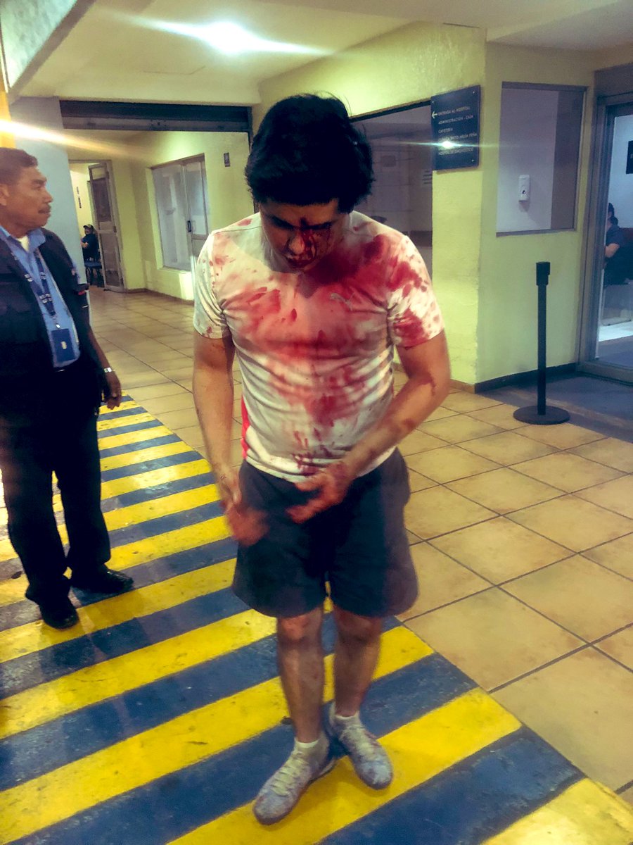 LauraPocaSV's tweet photo. Sí sacaste a tu hijo del país @AlexOviedoTCS, NO solo sos cómplice.

También estas dejando que el monstruo crezca, encima tu hijo será un prófugo por el resto de su vida y jamás volverá a poner un pie en El Salvador.

Enséñale a que responda por sus actos!

Quien no educa a sus hijos, la autoridad se encargará de hacerlo!