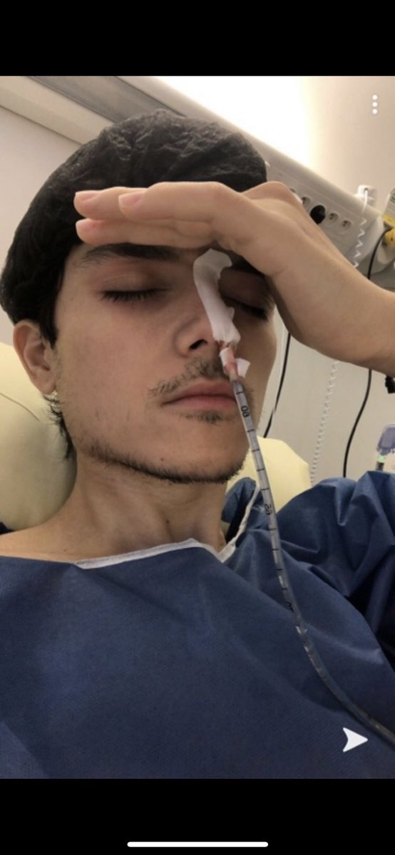 kev.teix tweet media