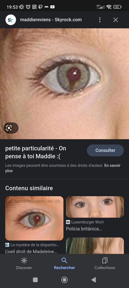 MavaSgh's tweet photo. @matouvu95 Maddie à une anomalie génétique à son oeil dit "oeil de chat" pas besoin d'analyse ADN les parents vont s'en rendre compte https://t.co/F9EDI0fcu2
