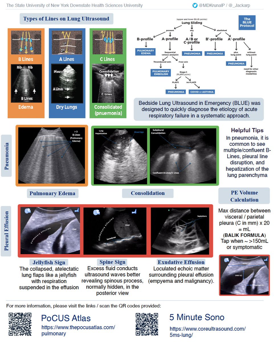 ICU OnePager tweet media