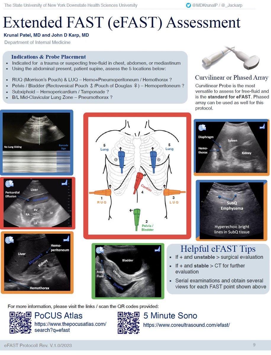 Cool POCUS OnePagers!