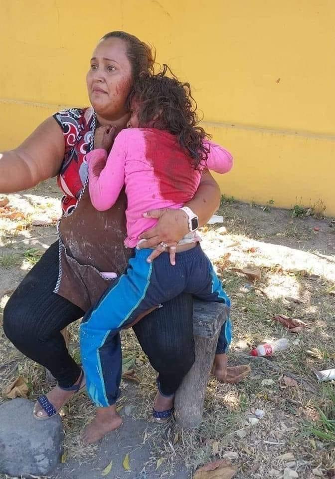 lexpineda's tweet photo. Una niña fue atacada esta mañana por un perro de raza Pitbull en la lotificación Miraflores, cerca del desvío a San Pedro Masahuat, La Paz. Las versiones indican que la niña iba a dejar tortillas cuando el animal se lanzó sobre ella, aprovechando que la puerta estaba abierta. https://t.co/ONcG7lUpgg