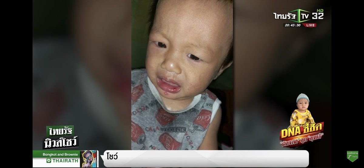 EarnLuv's tweet photo. เด็กๆอย่าเพิ่งท้องก่อนวัยกันเลยลูก แค่ตัวเองยังดูแลไม่ดี มีลูกจะดูแลได้ยังไง ตั้งแต่เห็นรูป #น้องต่อ คือเป็นโรคผิวหนังทุกรูป ไม่ก็ติดเชื้อจนเป็นแผล การดูแลรักษา&amp;ความสะอาดไม่ดีแน่นอน แค่หมอนที่เจอเลือดน้องก็สกปรกมากแล้ว วันที่หายไปเป็นไข้ แถมแม่ใช้มีดโกนหัวจนเป็นแผลหลายจุดอีก😞 https://t.co/JzFbGgLxNz