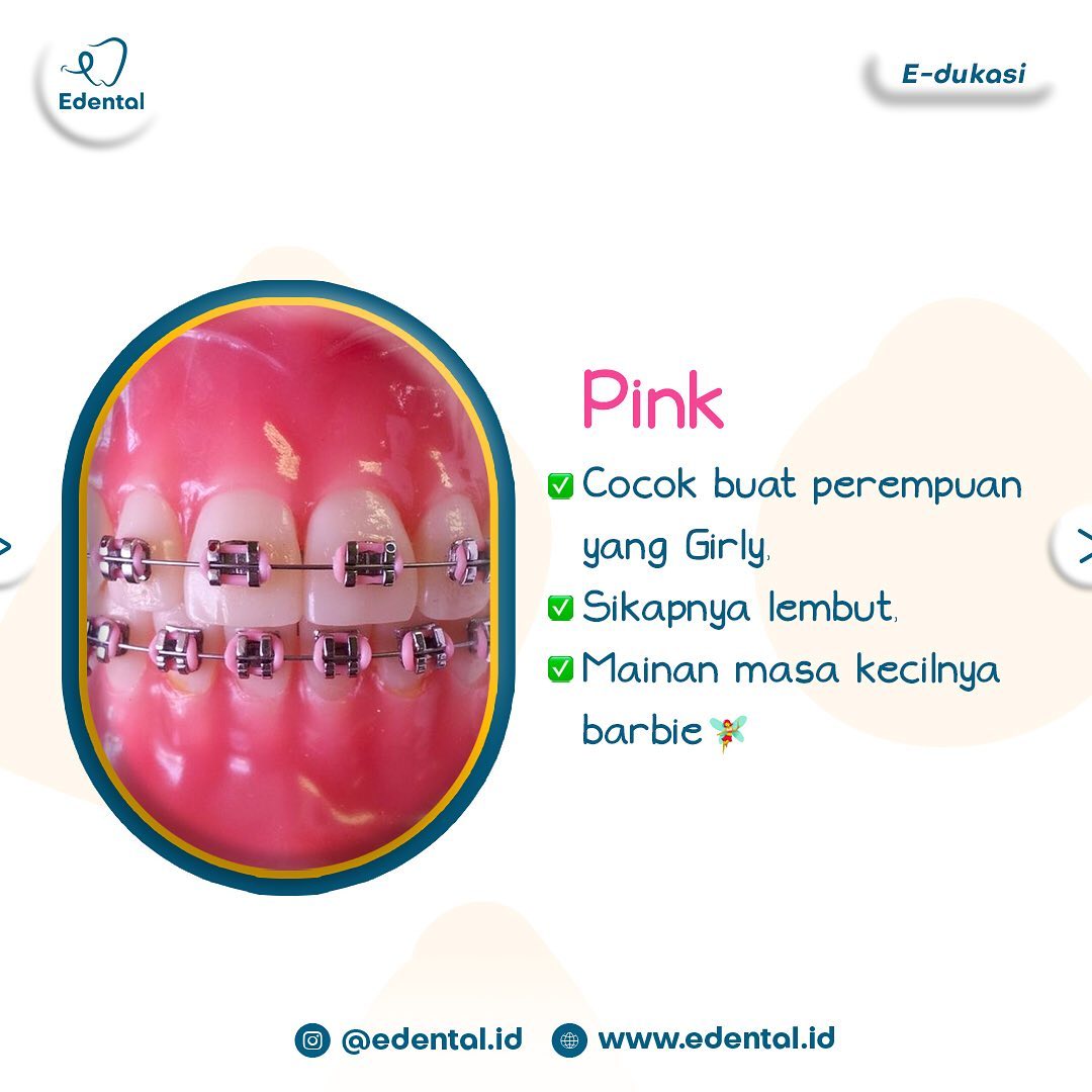 Edental001's tweet photo. Nah kalo karet behel kamu warna pink, kamu orangnya girly dan feminin 😁

#Trending #PROMO #karetbehel #behelgigi https://t.co/Zg6h0cF8AQ