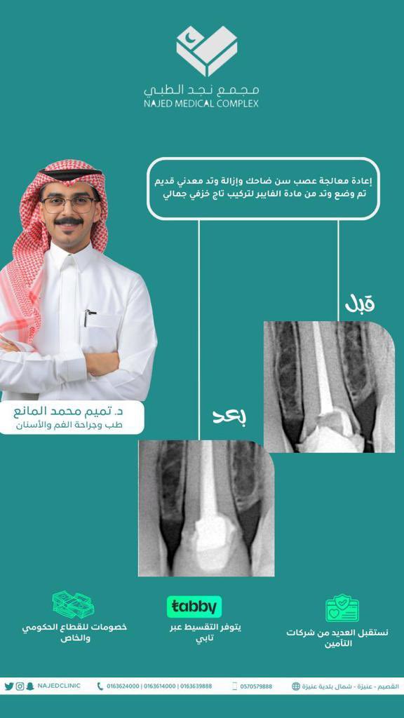 شغل دكتور تميم المانع الجبار على الحالة 👏🏽✨

#مجمع_نجد #القصيم #عنيزة #نجد_الطبي
#مجمع_نجد_الطبي_في_عنيزة