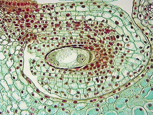 trickscd's tweet photo. “Vash has a plantussy (plant pussy)” 
me, a developmental biology major in graduate school: so you’re telling me this is inside his pussy my brother in christ https://t.co/M44lH7SL2e