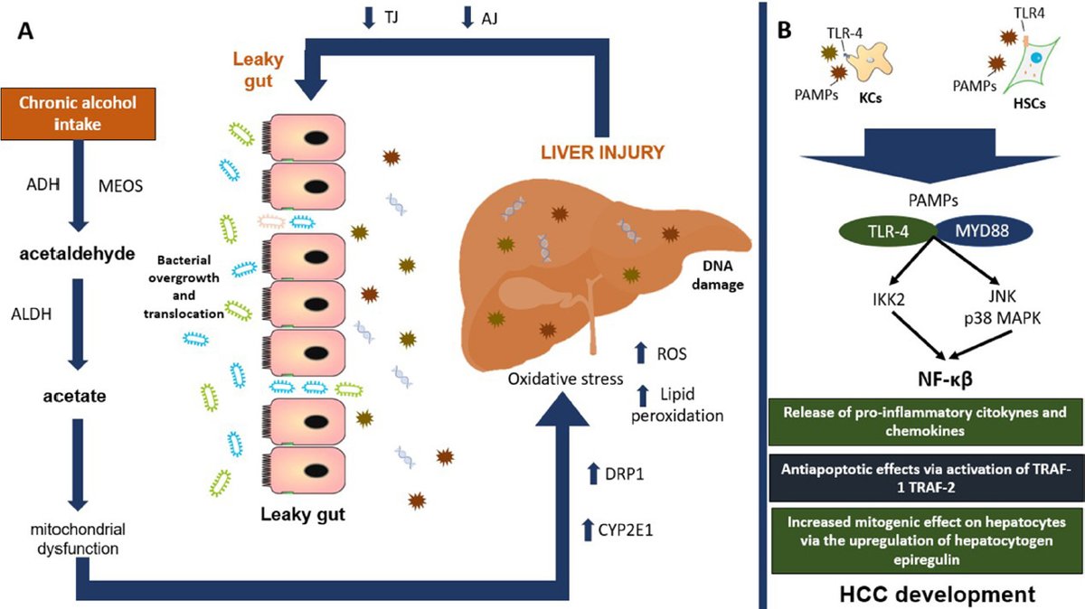 👍👍👍Never miss the excellent review from Prof. Nahum Méndez-Sánchez's team!
👀'The mechanism of dysbiosis in alcoholic liver disease leading to liver cancer'

🔗hrjournal.net/article/downlo…

#ALD #HCC #gutmicrobiota #dysbiosis #GI #LiverTwitter