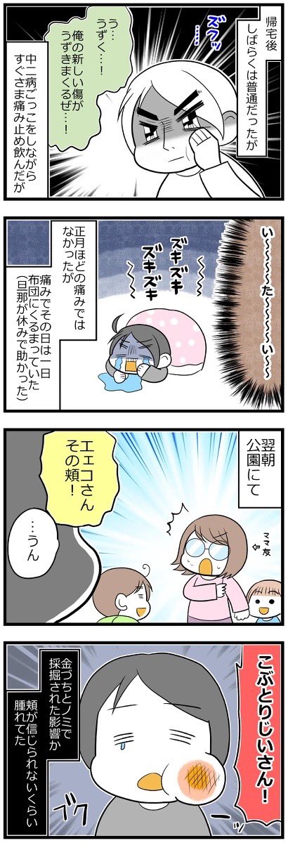 激痛!親知らずを抜くまで③完 