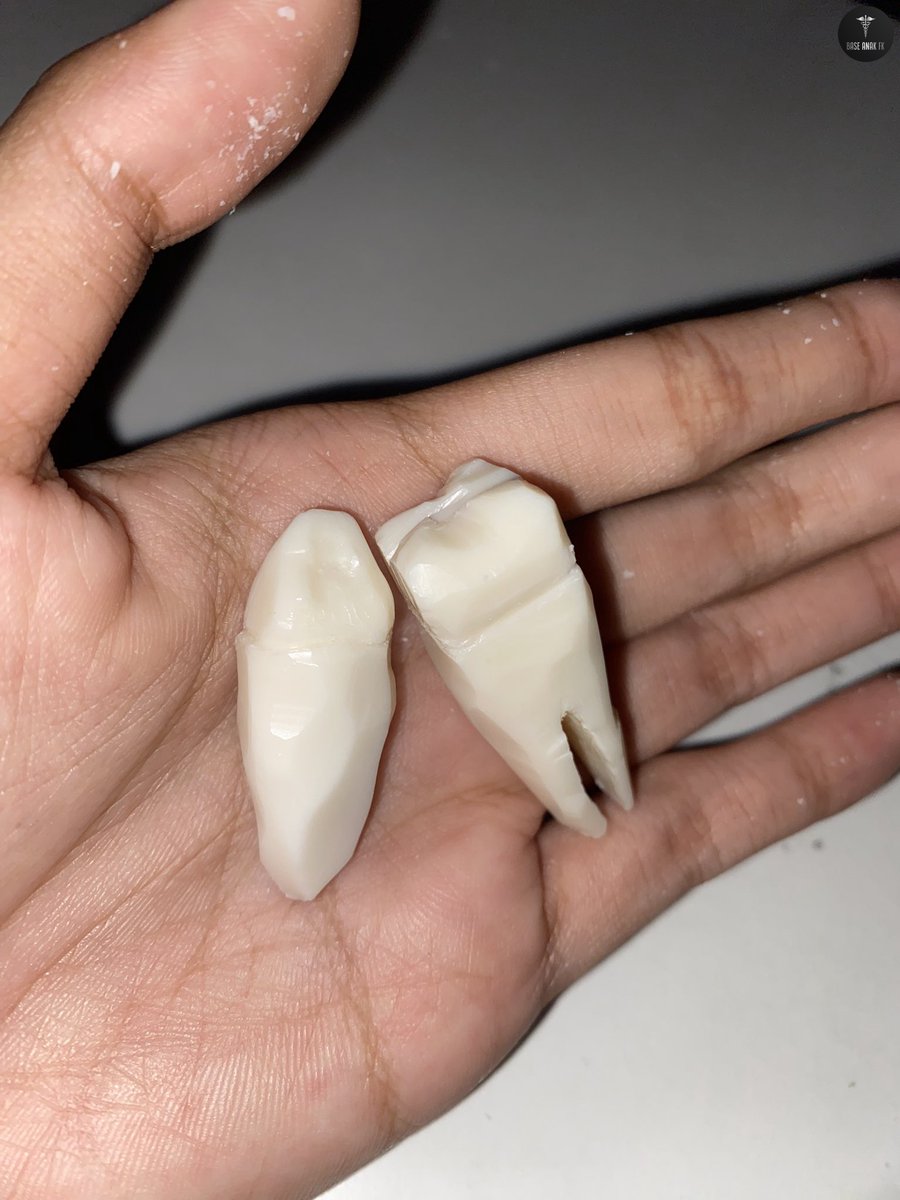 BaseAnakFK's tweet photo. dok besok lusa aku ada tes carving buat masuk FKG dan ini bnr2 first time nge carving. kira2 ada koreksi ga ya… thank u https://t.co/Kj085mNoBA