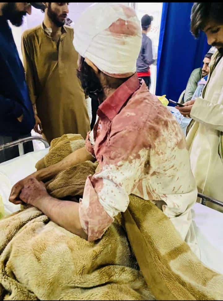 قائد اعظم یونیورسٹی اسلام آباد میں  پختون کونسل کے سینکڑوں  طلبہ  نے بلوچ طلبہ کو شدید تشدد کا نشانہ بنایا 30 طلبہ شدید
یہ وہی لوگ ہیں جو خود کو بلوچ کا بھائی بولتے ہیں،خودارا اپنا یہ ڈرمہ بند کریں یہاں بلوچ کا بھائی کوئی نہیں ہے،بلوچ کا بھائی صرف بلوچ ہے
#QUA