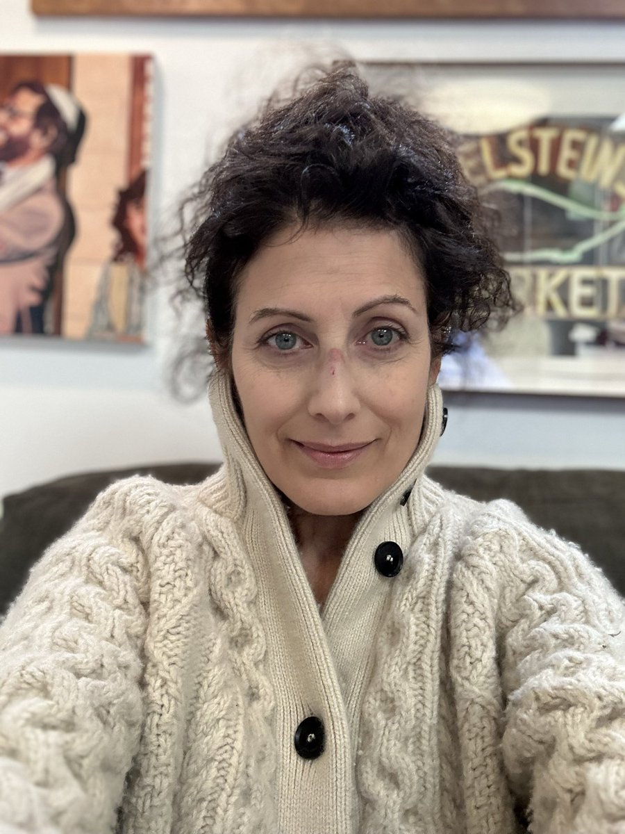 LisaEdelstein's tweet image. I walked into a door, my dad fell on his face and my mom had cataract surgery. HOW WAS YOUR WEEKEND??? #clumsy #ouch