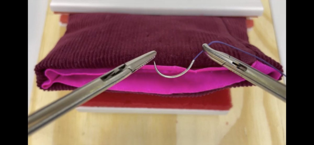 Angelina Carey-Love (@acareylovemd) on Twitter photo Lsc suturing of the vaginal cuff is a skill OB/GYN residents should feel comfortable performing after residency. To help, the #CCF #MIGS team created an educational module, now available on the <a href="/greenjrnl/">The Green Journal</a> YouTube channel! 😊<a href="/drcaraking/">Cara R. King, DO, MS, FACOG, FACS</a> <a href="/morlando_obgyn/">Megan Orlando, MD</a> ➡️ youtu.be/BEklcoUZmvc Lsc suturing of the vaginal cuff is a skill OB/GYN residents should feel comfortable performing after residency. To help, the #CCF #MIGS team created an educational module, now available on the <a href="/greenjrnl/">The Green Journal</a> YouTube channel! 😊<a href="/drcaraking/">Cara R. King, DO, MS, FACOG, FACS</a> <a href="/morlando_obgyn/">Megan Orlando, MD</a> ➡️ youtu.be/BEklcoUZmvc