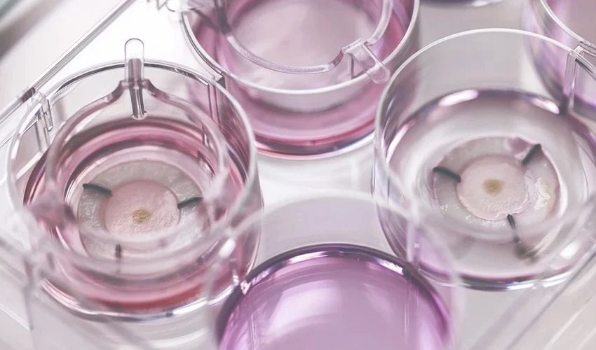 <a href="/CHANEL/">CHANEL</a> has collaborated with French start-up <a href="/LabskinC/">LabSkin Creations</a> to create #3Dprinted skin to research skin pigmentation irregularities.

They hope to create better skincare lines using this dermatological information.💄

3dnatives.com/en/chanel-has-…