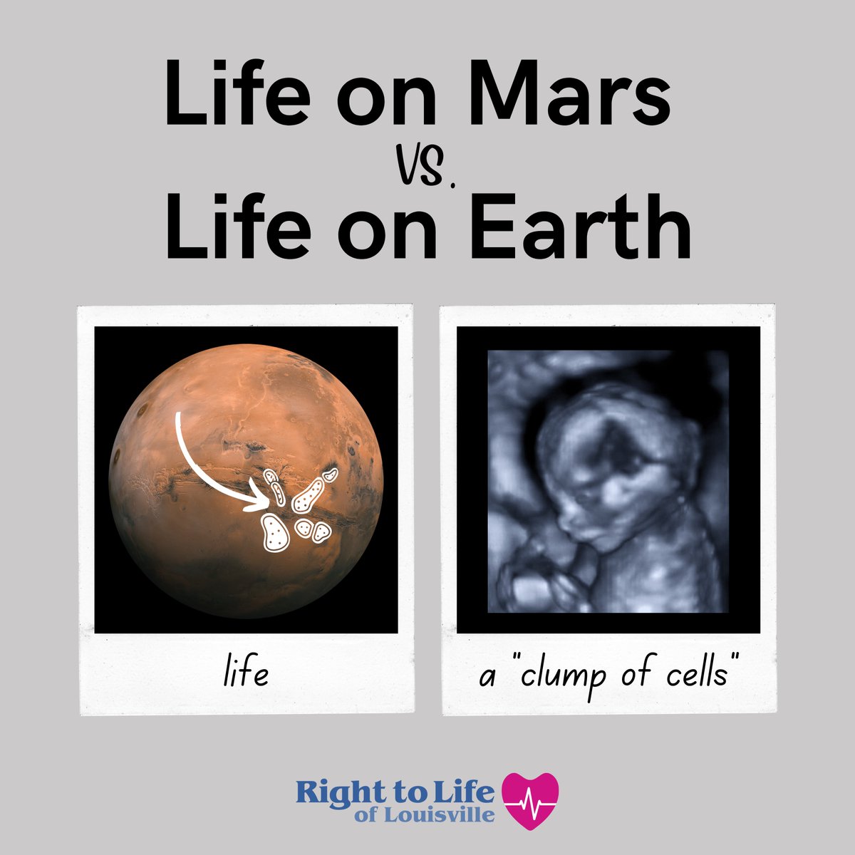 rtllou's tweet image. 96% of biologists surveyed believe life begins at fertilization. Why have we allowed the abortion industry to redefine life in an attempt to conceal the horror of abortion? Life begins at conception! #prolife #prowoman #proscience