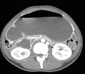 American College of Radiology tweet media