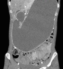 American College of Radiology tweet media