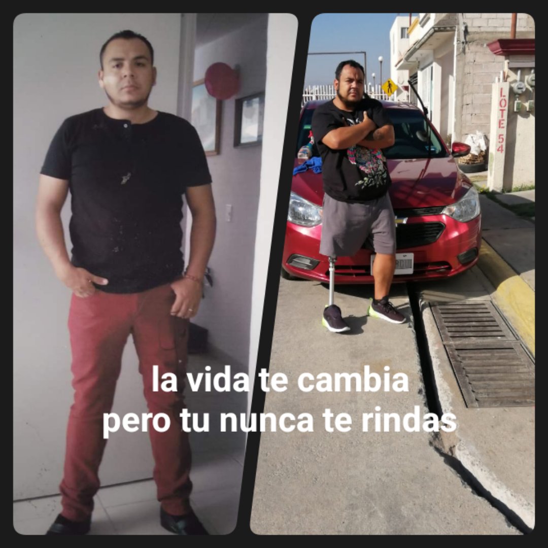 Romariobo89's tweet photo. @aesquinca que tal toño hace un rato hablabas de los cambios yo tuve un cambio radical en mi vida sólo podría transmitir que no se rindan ha y soy chófer de plataforma uber gracias por compartir tu conocimiento cabe mencionar que mi accidente fue hace 4 años https://t.co/jaRvbHjV8z