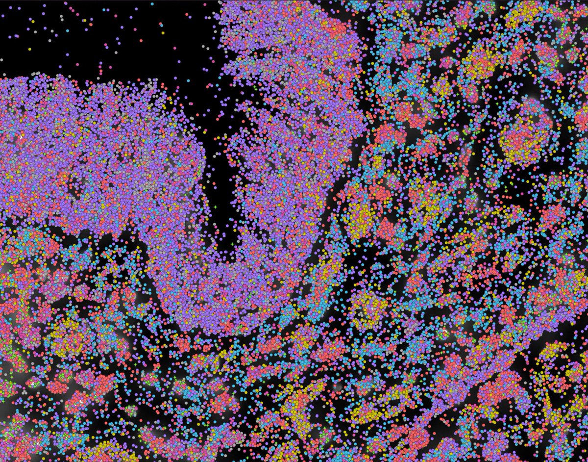 Nick Banovich (@nebanovich) on Twitter photo Small piece of an airway from our first real Xenium run. Over 34M transcripts across a 1.5cm^2 region. Not a bad first shot on goal!
<a href="/10xGenomics/">10x Genomics</a>
#spatialtranscriptomics
#spatialbiology Small piece of an airway from our first real Xenium run. Over 34M transcripts across a 1.5cm^2 region. Not a bad first shot on goal!
<a href="/10xGenomics/">10x Genomics</a>
#spatialtranscriptomics
#spatialbiology