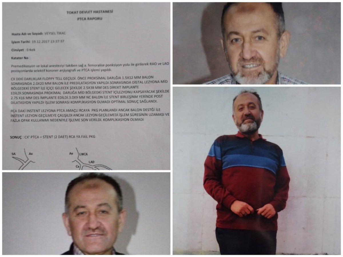 Hastalr_Tutuklu's tweet image. Kalbinde 7 stentle Temmuz 2017&apos;de tutuklanan ve cezaevinde kalbine 2 stent daha takılan KHK&apos;lı kalp hastası Veysel Tıkaç&apos;a, damarlarının deformasyonu nedeniyle artık müdahale edilemiyor.

Tıkaç, SESİNİ DUYURAMIYOR! @adalet_bakanlik

#EnkazdaBileKHKlı #helaletmiyorum #FOXHaber