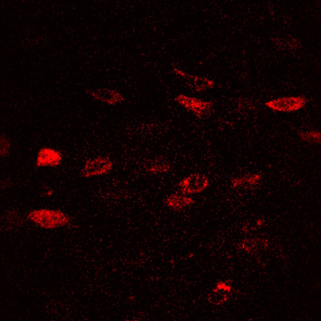 Our first preprint is on <a href="/biorxivpreprint/">bioRxiv</a>! Novel use of fluorescent nano particles to study osteocyte dynamics in vivo in collaboration with <a href="/GroupWiesner/">Wiesner Group</a>
in <a href="/CornellEng/">Cornell Engineering</a> !!! #orthotwitter 
tinyurl.com/OsteocyteCDot1