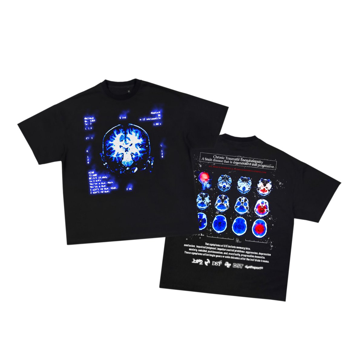 DEATHSPORTC's tweet photo. ENDING FEBRUARY OFF SPREADING CTE AWARENESS 🧠 - BLK T-SHIRT NOW AVAILABLE ONLINE 💻 https://t.co/RjFJqiEEEu
