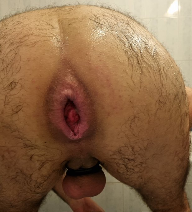 Fucked up hole from today's training. Think I made some depth progress! My second ring got fucking stretched<a href="/tag/chastity"class="tags"><span>#chastity</span></a><a href="/tag/boypussy"class="tags"><span>#boypussy</span></a><a href="/tag/manpussy"class="tags"><span>#manpussy</span></a><a href="/tag/mancunt"class="tags"><span>#mancunt</span></a><a href="/tag/wreckedhole"class="tags"><span>#wreckedhole</span></a>