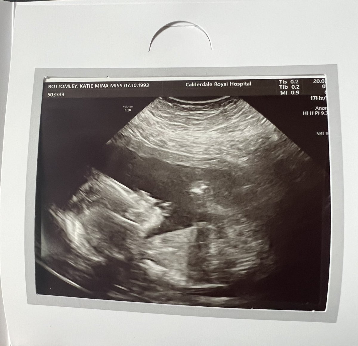 Katie Bottomley tweet media