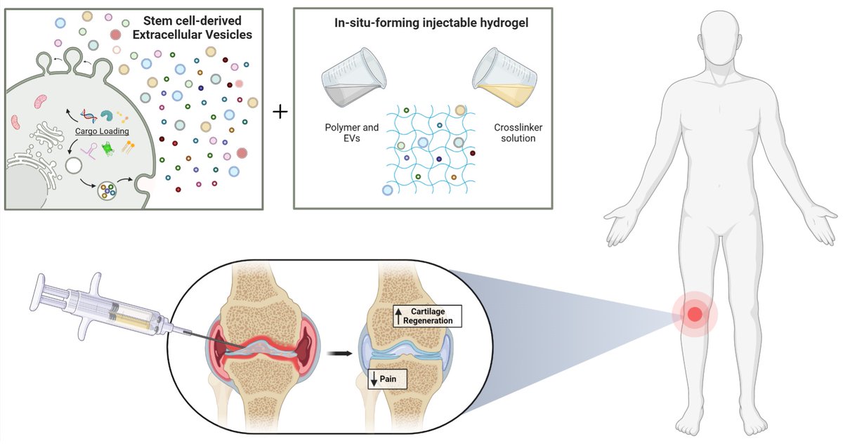 Magdalena Lorenowicz (@mjlorenowicz) on Twitter photo Check our freshly published review on the future of MSC-EVs as therapy for cartilage regeneration. <a href="/TVermonden/">Tina Vermonden</a> @jong_olivier
Congratulation to the talented first author Sanne van de Looij!
lnkd.in/ety6wCC4 Check our freshly published review on the future of MSC-EVs as therapy for cartilage regeneration. <a href="/TVermonden/">Tina Vermonden</a> @jong_olivier
Congratulation to the talented first author Sanne van de Looij!
lnkd.in/ety6wCC4
