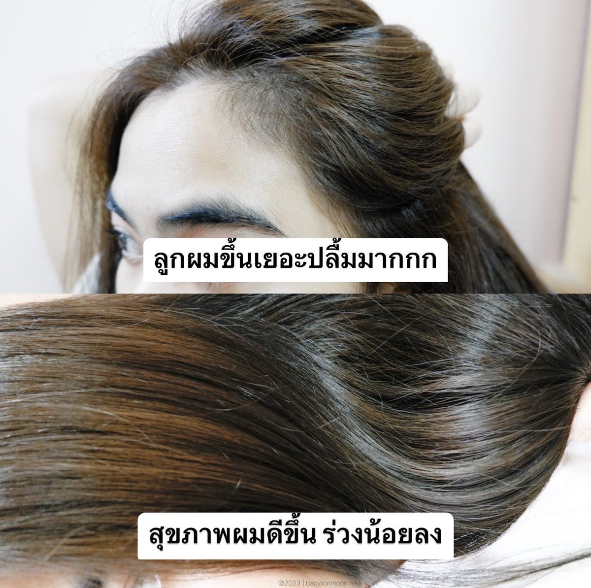 My Image 4