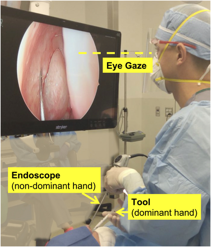 Triological's tweet photo. Anyone who has learned sinus surgery knows there is a steep learning curve! In this study by Berges et al. from @hopkins_ent, significant differences in eye gaze and endoscope motion were identified between novice and experienced sinus surgeons. 

https://t.co/yT8hve9SRU https://t.co/uS5qguWoN9