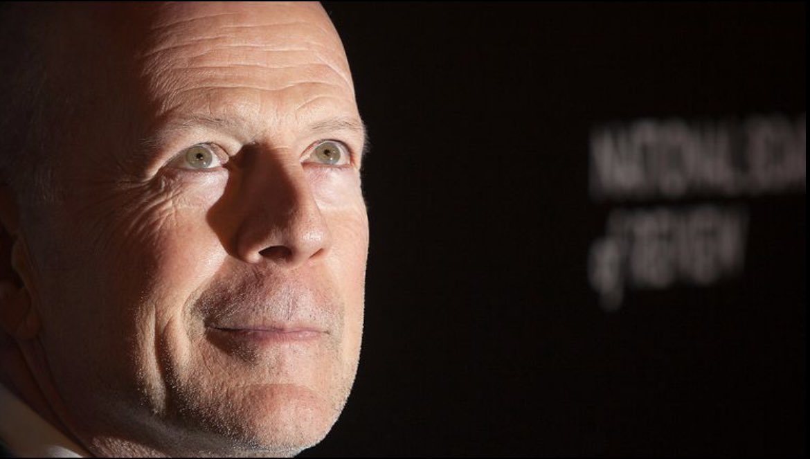 Bruce Willis’ family have announced that he has been diagnosed with frontotemporal dementia. Head over to our website to have a read through the description and symptoms of the most common types of dementia diagnosed: theinnovatecentre.com/information #dementia #alzheimers #socialcare