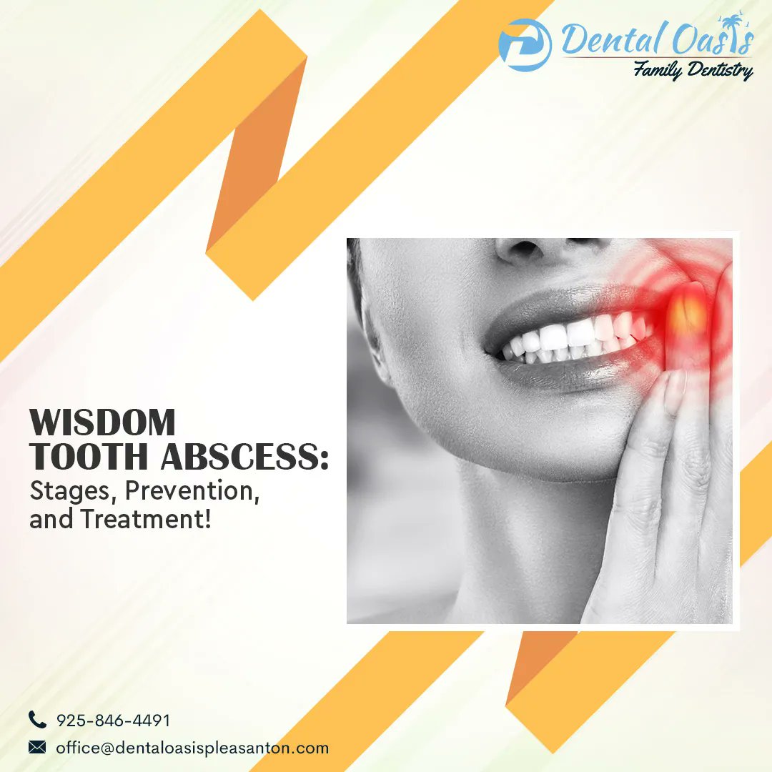 Wisdom Tooth Abscess: Stages, Prevention, and Treatment! 

buff.ly/3EccoqD 

#WisdomTooth #ToothAbscess #WisdomToothExtraction #WisdomToothTreatment #DentalTreatment
