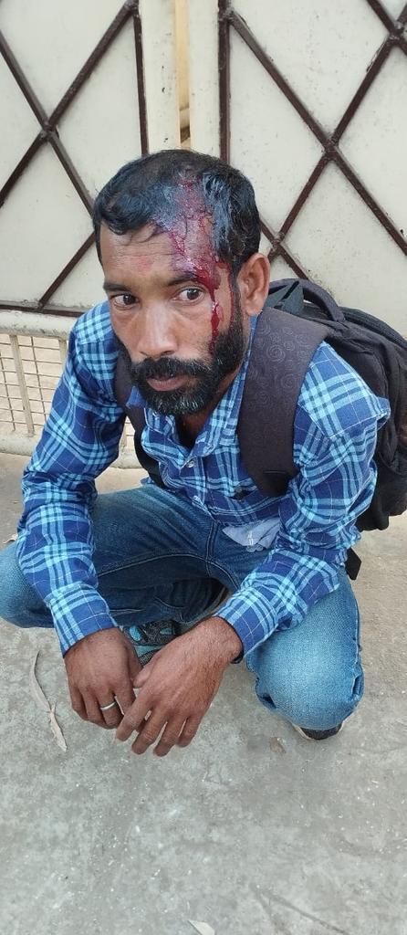 Virendr10575435's tweet photo. देखिये हेमंत सोरेन जी आपका तानाशाही पुलिस प्रशासन ने पंचायत सचिवालय स्वयं सेवको को बुरी तरह से लाठी चार्ज कर सिर,हाथ, पैर तोड़ दिया। उन्होंने अपनी 5 सूत्री मांगो को लेकर राजभवन के समीप शांति पूर्वक धरना प्रदर्शन कर रहे थे
@HemantSorenJMM
@JharkhandCMO 
@INCJharkhand 
@yourBabulal https://t.co/t8xrEWESVH
