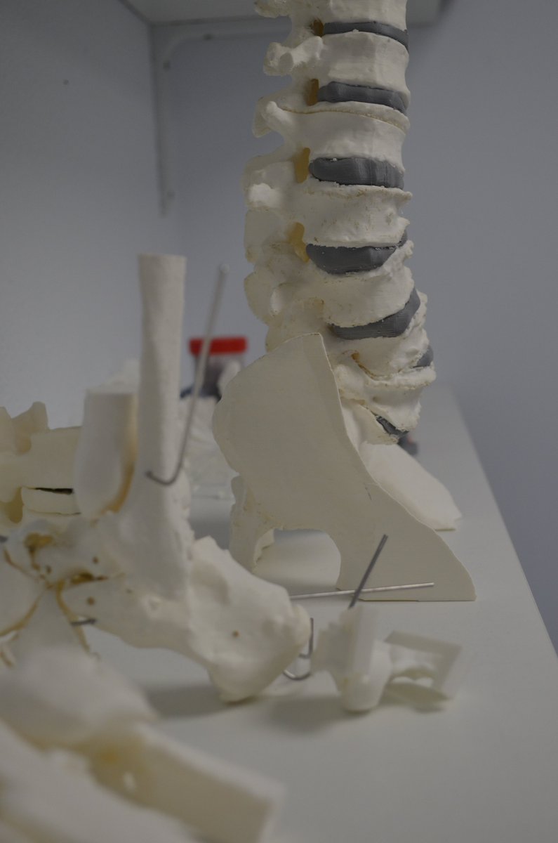 3dEbre's tweet image. #anatomicalmodel #medical3dprinting #medicalsimulation #surgicalplanning