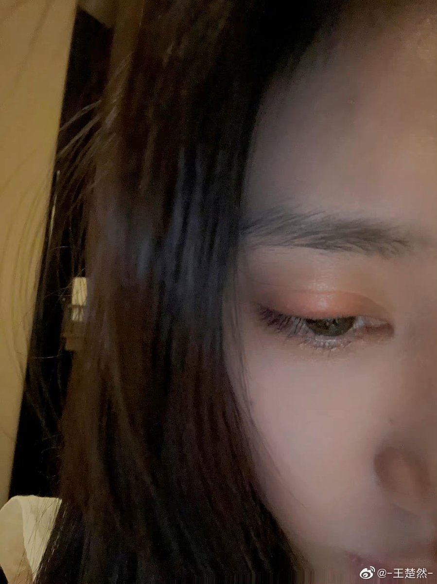 wangchurans's tweet photo. #WangChuran’s weibo update 

“The nth day of being hurt by a stye……😭”

#王楚然 https://t.co/DVTeYsVm7A