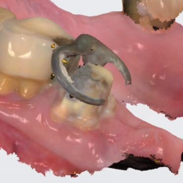 Hallmark Dental Lab tweet media