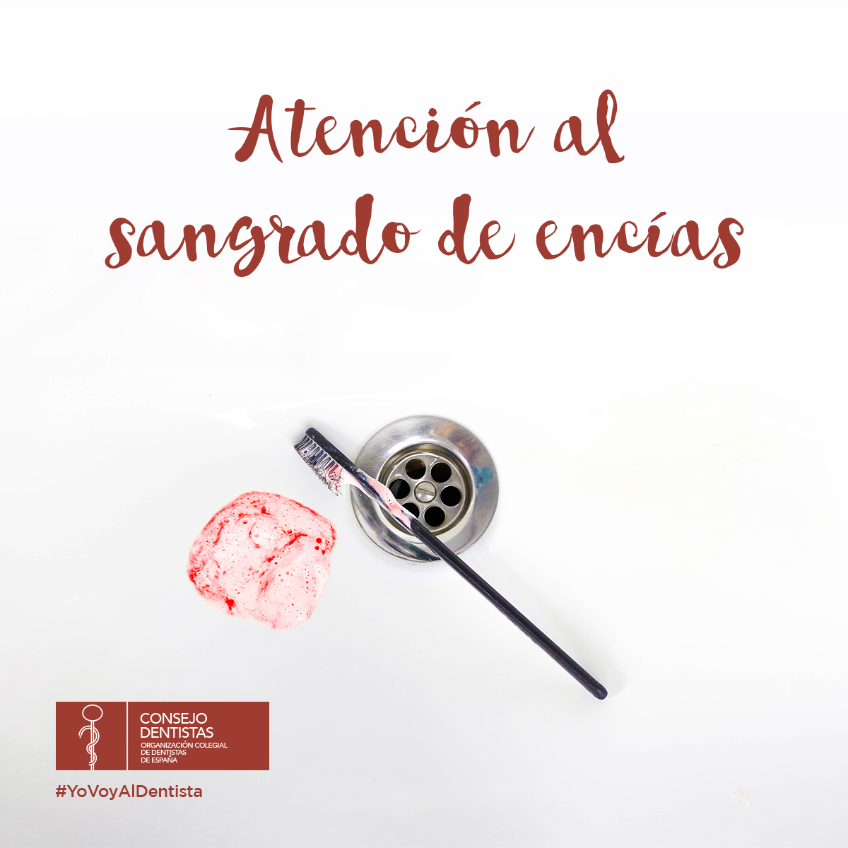 CNSJ_Dentistas's tweet image. El sangrado de encías debe atenderse siempre, es una de las señales de alarma de que puede estar desarrollándose una patología periodontal que, si se ignora, puede generar una pérdida ósea irrecuperable. No esperes al dolor para acudir a tu dentista.