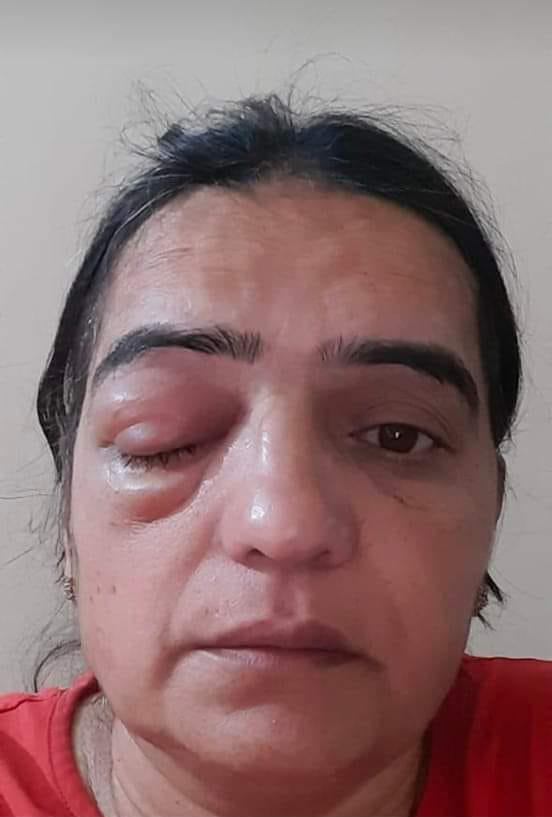 यह है अच्छे दिन! यह है आजादी का अमृत महोत्सव ! जो हमारे कर्मचारी माता भगिनीनो पर लाठीचार्ज करें। आप के यह दिन हम और आप भी भूलेंगे नहीं ।#voteforOPS
#पुराणी_पेंशन_बहाली_हो
<a href="/BJP4India/">BJP</a>
<a href="/INCIndia/">Congress</a> 
<a href="/mlkhattar/">Manohar Lal</a> 
<a href="/Dchautala/">Dushyant Chautala</a> 
<a href="/narendramodi/">Narendra Modi</a> 
<a href="/RahulGandhi/">Rahul Gandhi</a> 
<a href="/ArvindKejriwal/">Arvind Kejriwal</a> 
<a href="/MamataOfficial/">Mamata Banerjee</a>