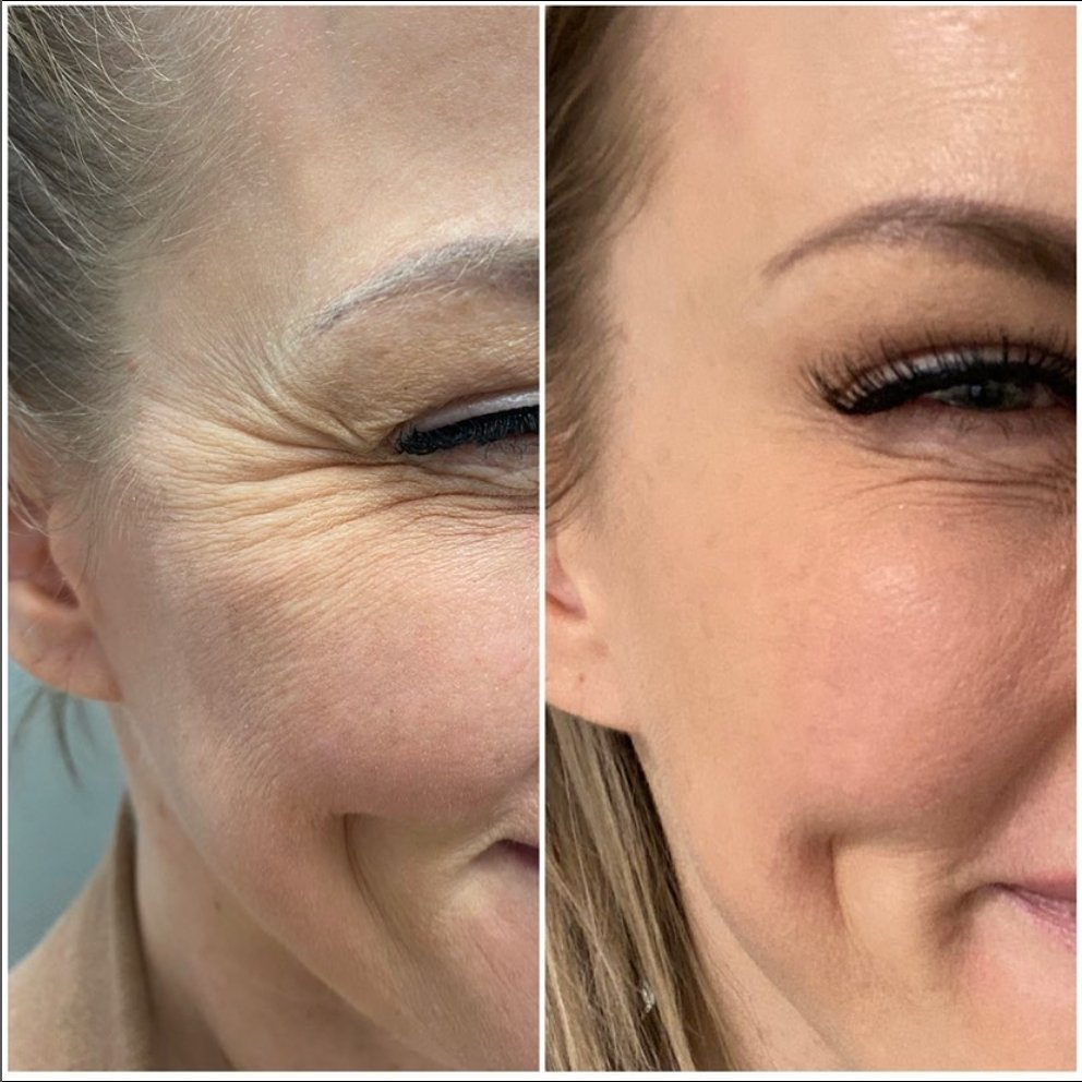 MD_Spa's tweet image. Contact us today:
Call: (780)9299797
Text: (780)9349021
DM: @MDSPALASER
Email: beaumont@mdspa.ca
Web: mdspa.ca

#edmonton #yeg #yeglocal #yegbusiness #alberta
#esthetician #esthetics #spaday #cosmetics