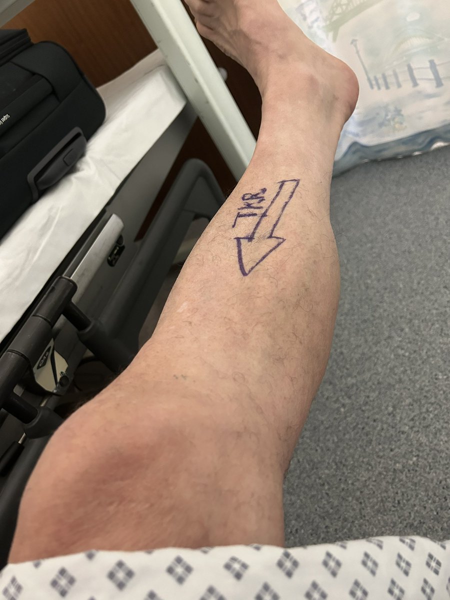 Six hours into a new knee. Total knee replacement at the Freeman Hospital, Newcastle upon Tyne. All good so far but a wee bit painful now. Already walked on it #tkr #knee