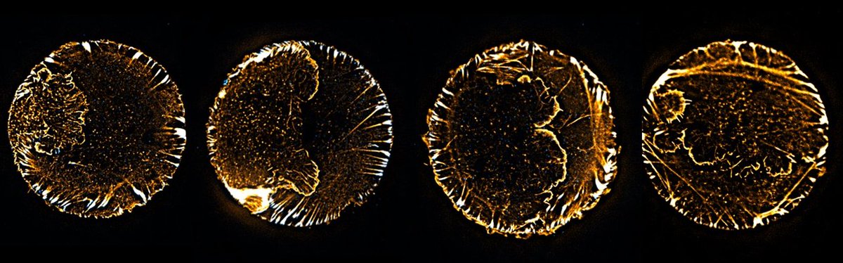 reenak52086225's tweet image. Sometimes images from the archive folder are aesthetically pleasing :)
 Cells on #micropattern #actin #focaladhesion 
#sciart #cellbiology #geometry