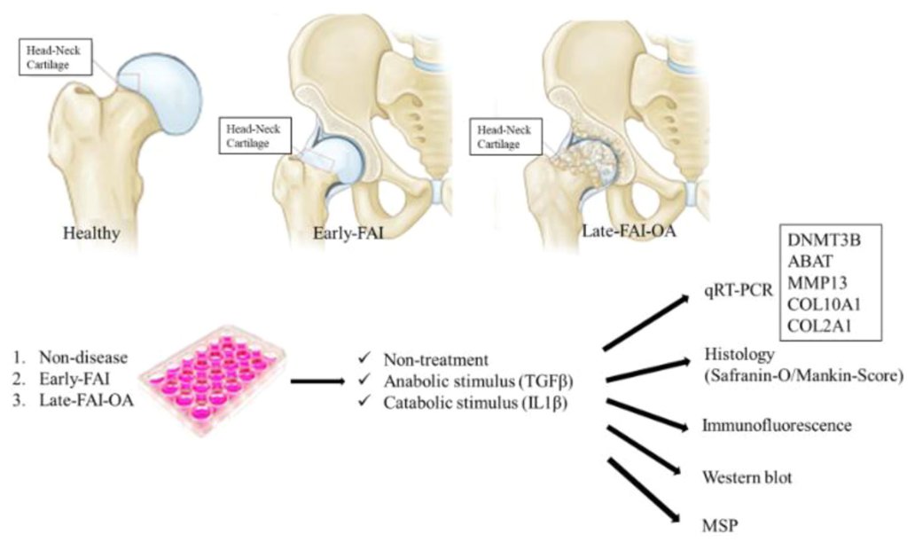 Carolyn Chlebek, PhD (@carolyn_chlebek) on Twitter photo <a href="/CeciPGarrido/">Cecilia Pascual-Garrido, MD, PhD</a> and colleagues recently published evidence in <a href="/JOrthopRes/">Journal of Orthopaedic Research®</a> suggesting a gradual epigenetic dysregulation occurs during #osteoarthritis progression. This work used #human samples from patients suffering from #FAI. <a href="/ORSsociety/">Orthopaedic Research Society</a>
#ORSSMC
doi.org/10.1002/jor.25… <a href="/CeciPGarrido/">Cecilia Pascual-Garrido, MD, PhD</a> and colleagues recently published evidence in <a href="/JOrthopRes/">Journal of Orthopaedic Research®</a> suggesting a gradual epigenetic dysregulation occurs during #osteoarthritis progression. This work used #human samples from patients suffering from #FAI. <a href="/ORSsociety/">Orthopaedic Research Society</a>
#ORSSMC
doi.org/10.1002/jor.25…