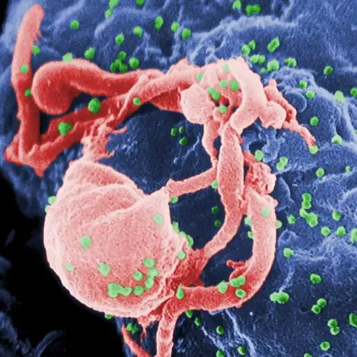 🚨URGENTE: Cientistas anunciam a cura de um homem com HIV após receber tratamento contra câncer de células-tronco.