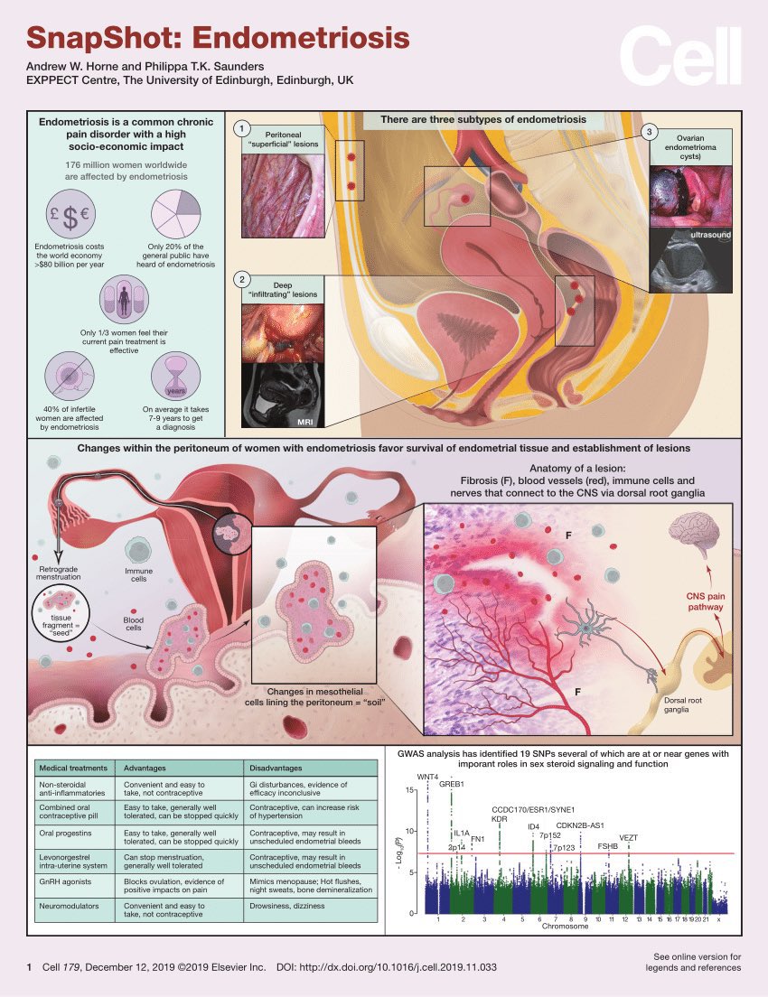 AdvReproduction's tweet photo. Endometriosis

#IVF #sperm #SciComm #Research #ScienceTwitter #technology #AcademicChatter #meded #MedTwitter #Infertility #reproductivehealth #endometriosis 

Credit: @CellCellPress https://t.co/oXq6WA8HKn