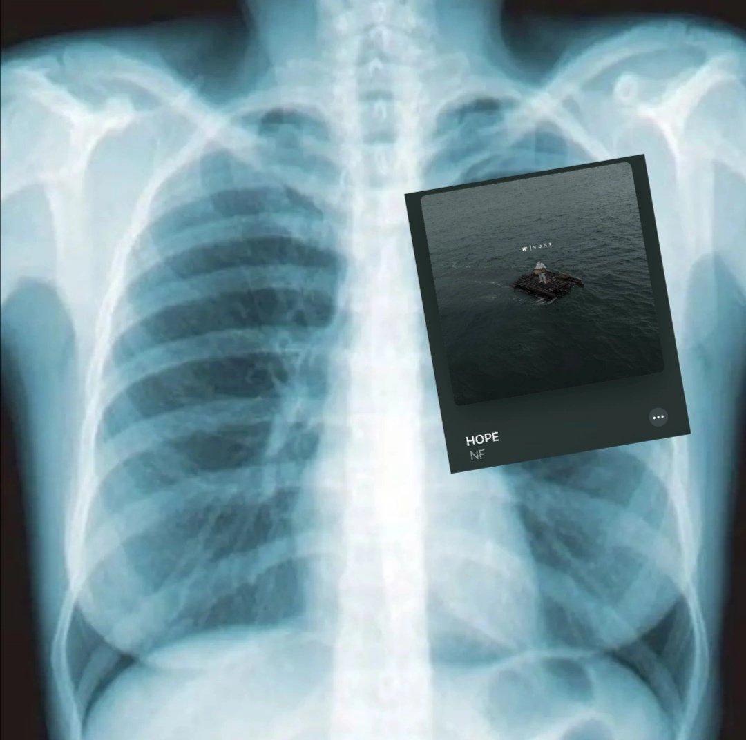 nfrealkey's tweet photo. Image of my x-ray for the last 4 days: https://t.co/zPrwABbYKI