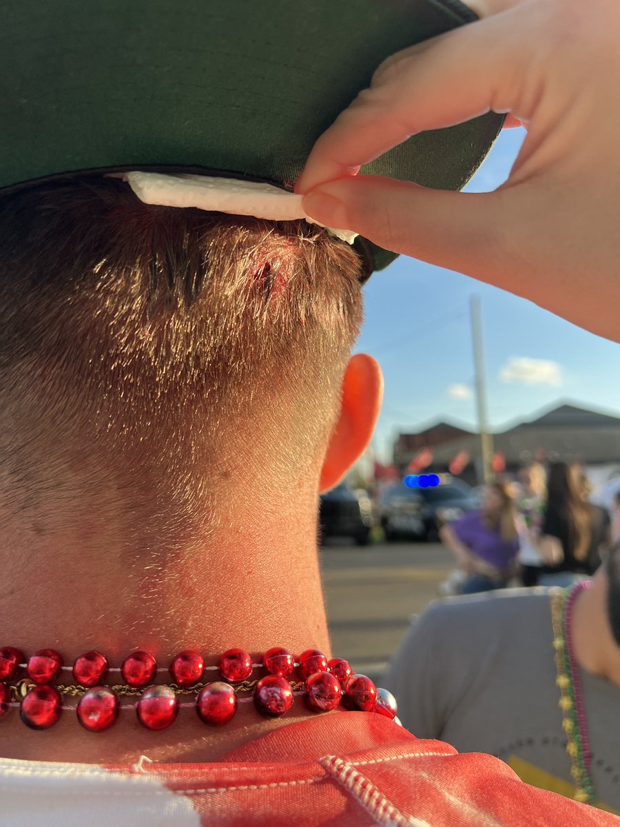 andrewbenoit21's tweet photo. Standing on the yellow car in @RoxsBar is unsafe  

Source: Trust me bro https://t.co/eOV3vycCaP