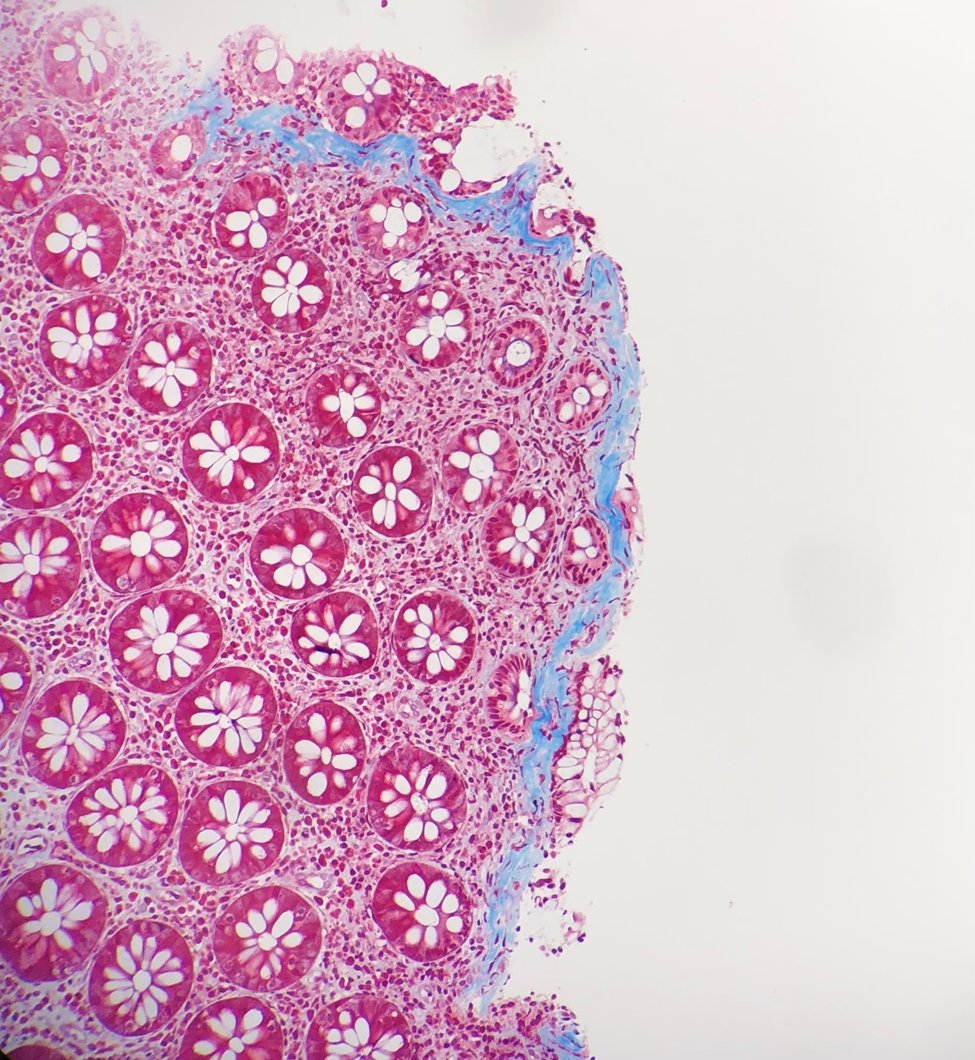 MhPathology tweet picture