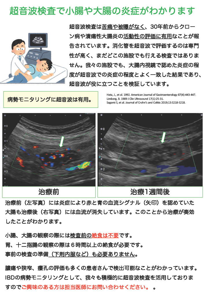 IBD59604947's tweet photo. 当センターでは腸管エコーによる負担の少ない検査を日本で最も力を入れています #腸管エコー #超音波検査 #炎症性腸疾患 #IBD #潰瘍性大腸炎 #クローン病 #UC #CD https://t.co/mnQj3blD4n