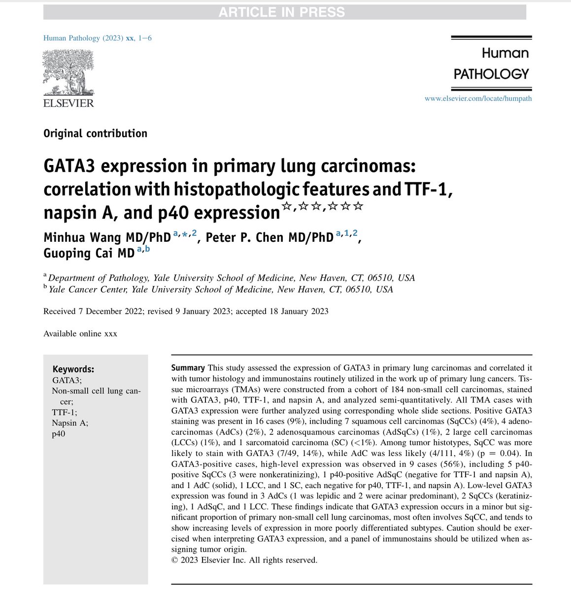 IHC Pitfall: GATA3 can be expressed in a subset of primary lung carcinomas. authors.elsevier.com/c/1gdR8AfIPlwN…